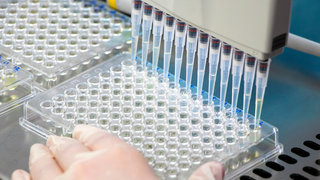 abbexa - Preparing samples for ELISA ( ELISA 樣品準備) - Serum, Plasma,Tissue Homogenates ,Cell Culture Supernatants,Cell Lysates